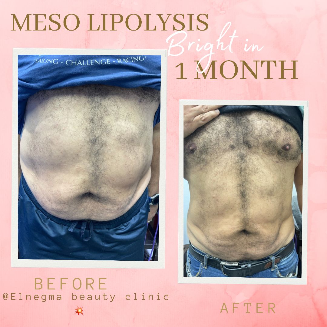 نحت الجسم عيادة النجمة