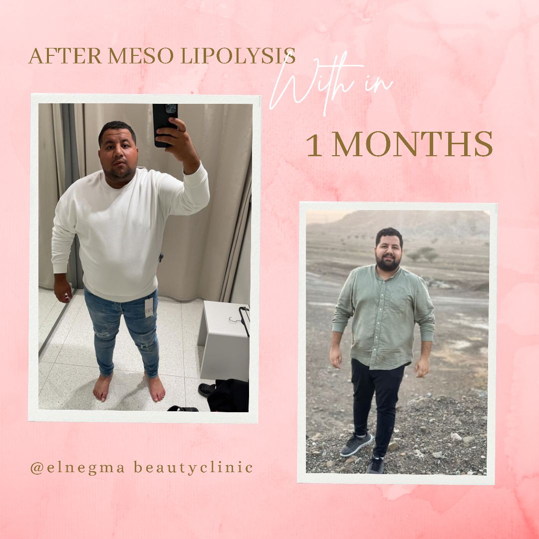 نحت الجسم عيادة النجمة