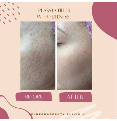 علاج البشرة عيادات النجمة