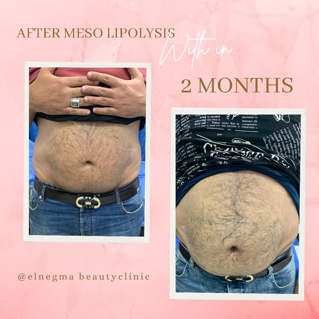 نحت الجسم عيادة النجمة