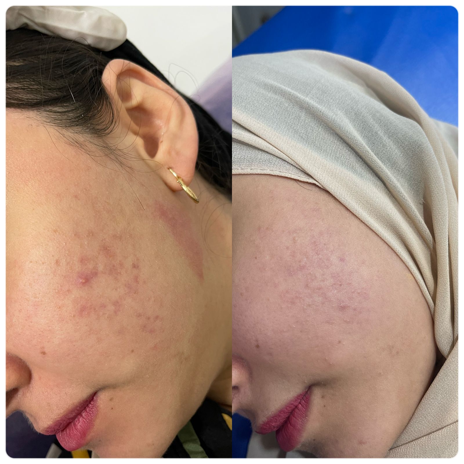 علاج البشرة عيادات النجمة