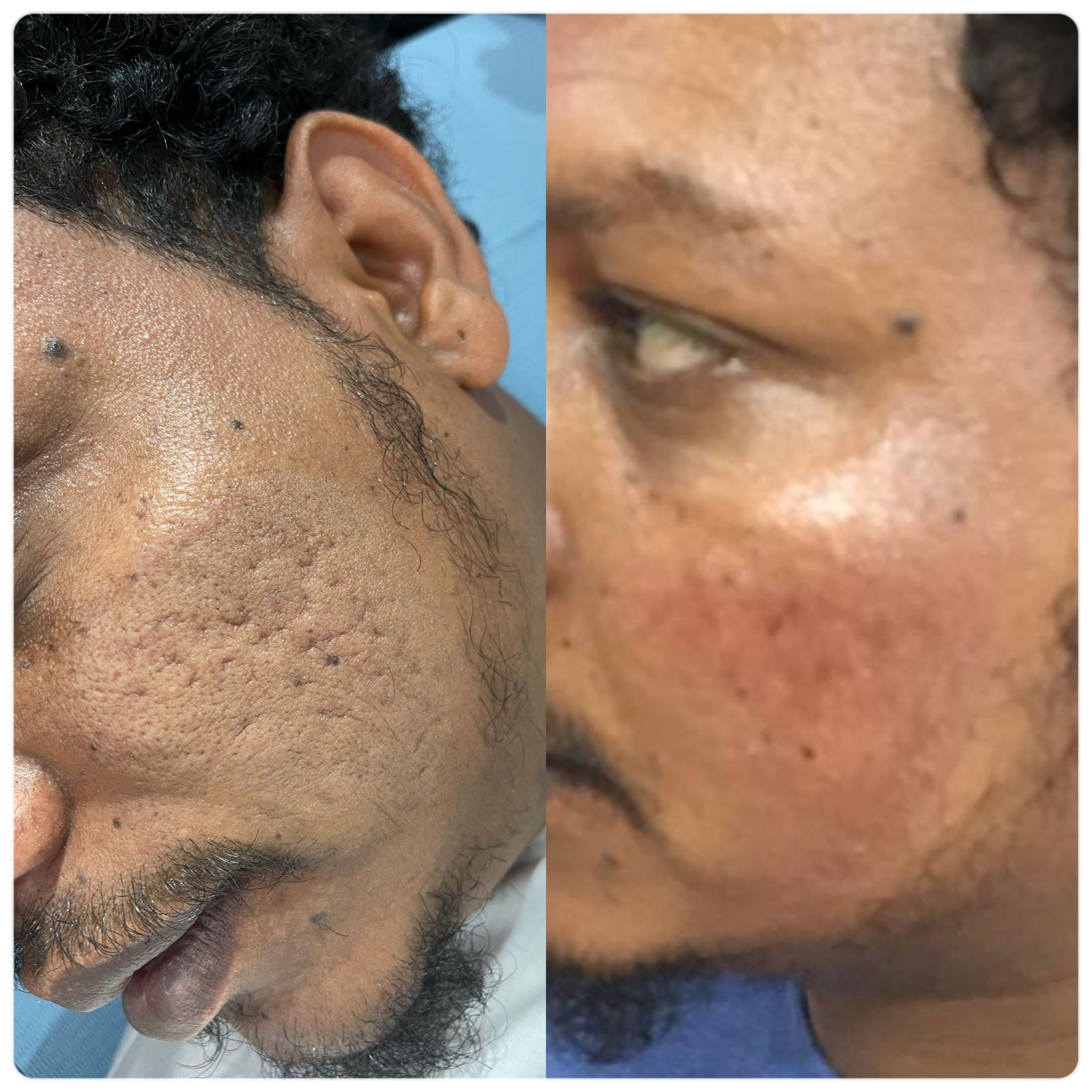 علاج البشرة عيادات النجمة