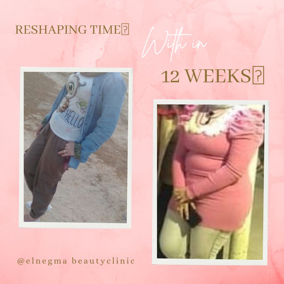 نحت الجسم عيادة النجمة