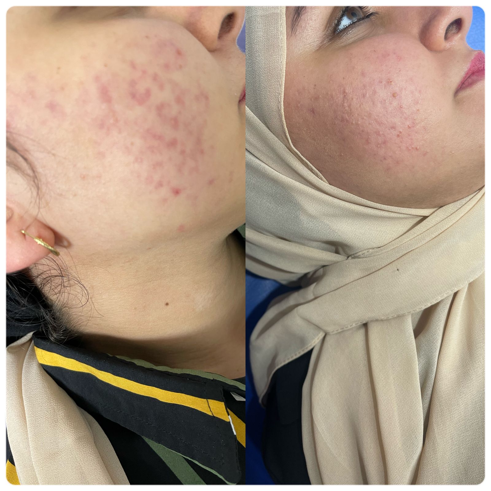 علاج البشرة عيادات النجمة