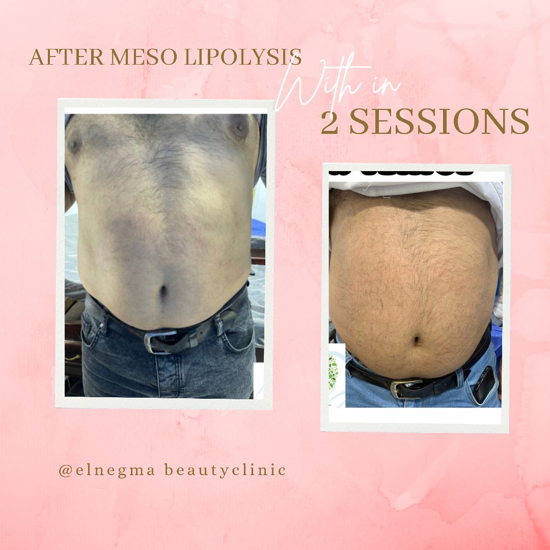 نحت الجسم عيادة النجمة