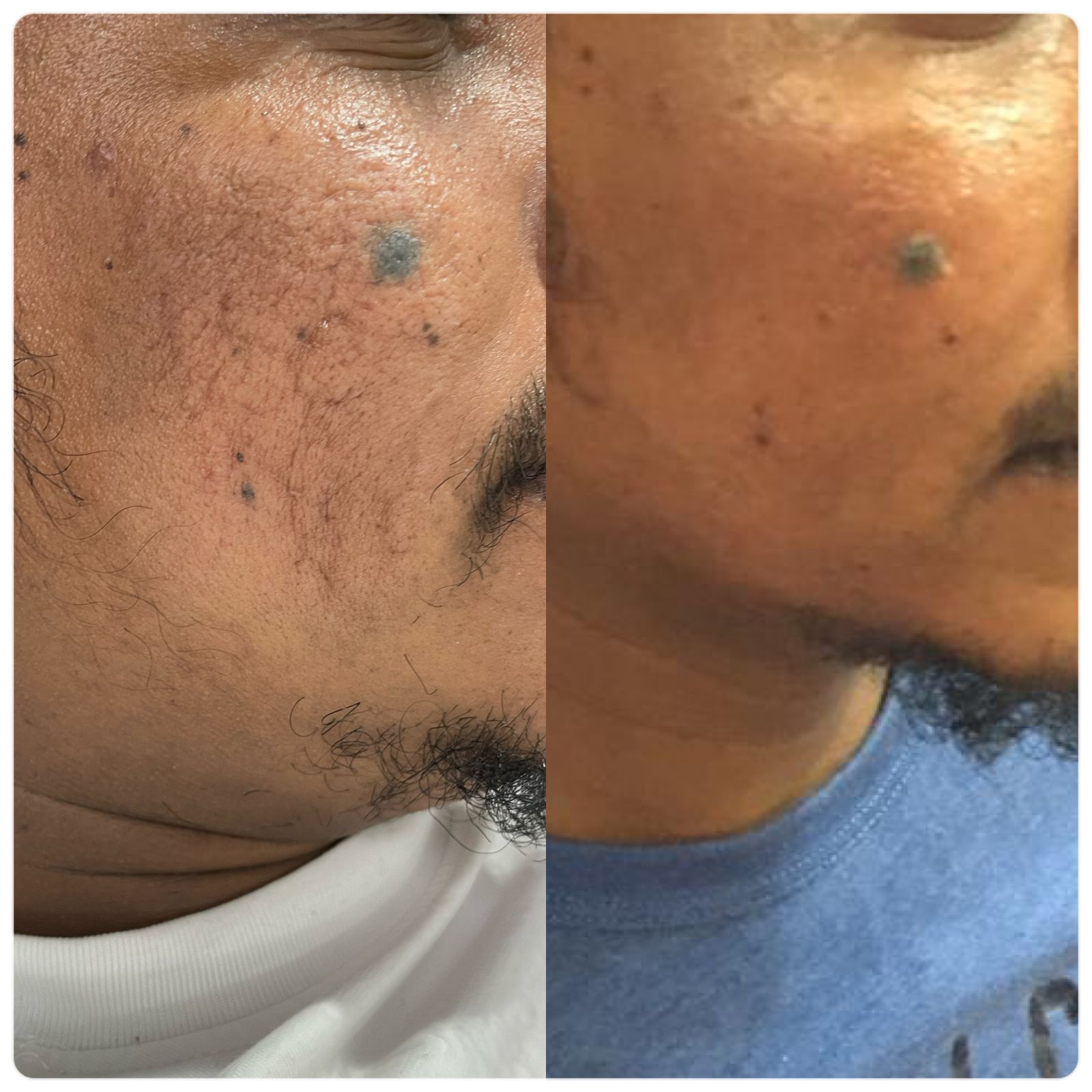 علاج البشرة عيادات النجمة