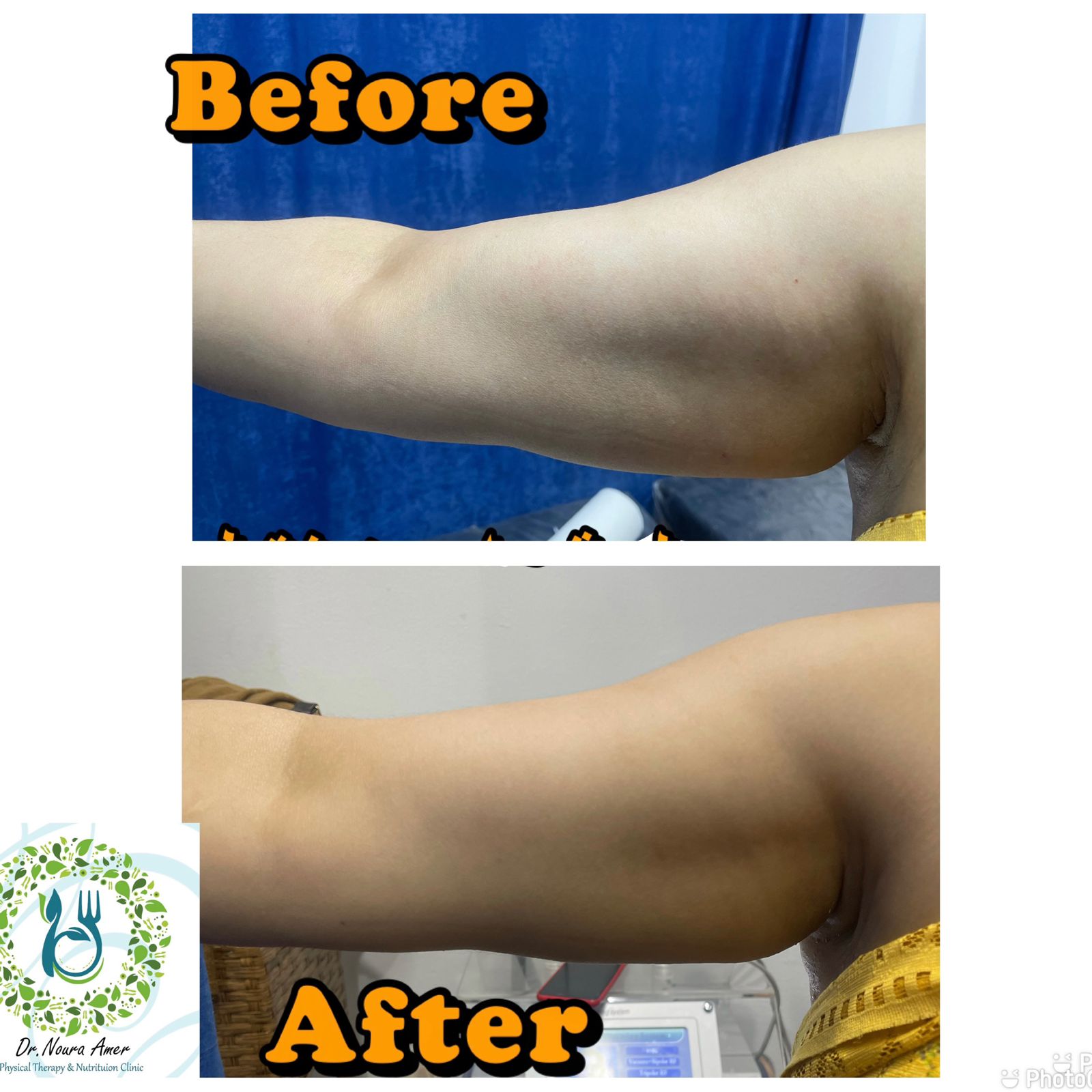 نحت الجسم عيادة النجمة